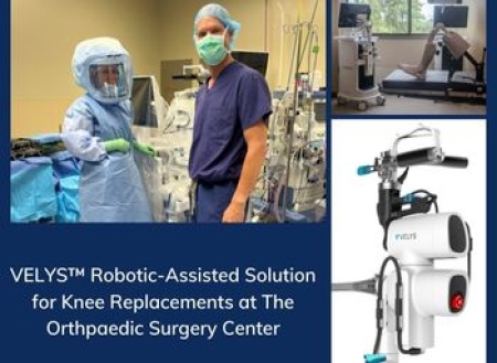 Introducing the VELYS™ Robotic-Assisted Solution for Knee Replacements